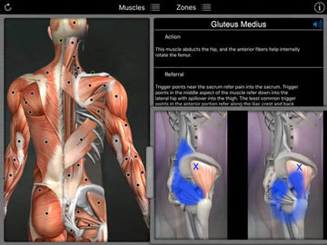 muscle-trigger-poitns